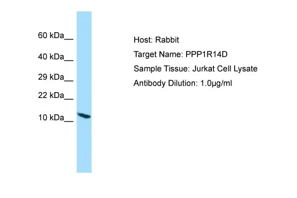 PPP1R14D / CPI17-Like Antibody (aa9-58)