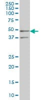 Monoclonal Mouse anti-Human SEPHS2 Antibody (clone 2G9, IHC, WB)