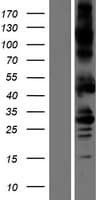 ALK2 / ACVR1 Protein (Over-Expression Lysate Myc-DDK (Flag))