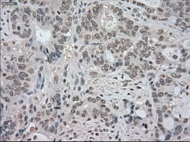 NTRK3 / TRKC Antibody (clone OTI2B8)