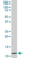 TIMM9 Antibody (clone 1D6)