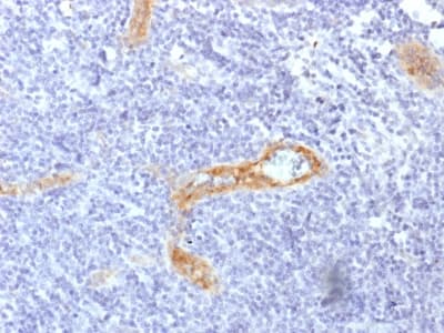VWF / Von Willebrand Factor Antibody (aa1815-1939, clone rVWF/1465)