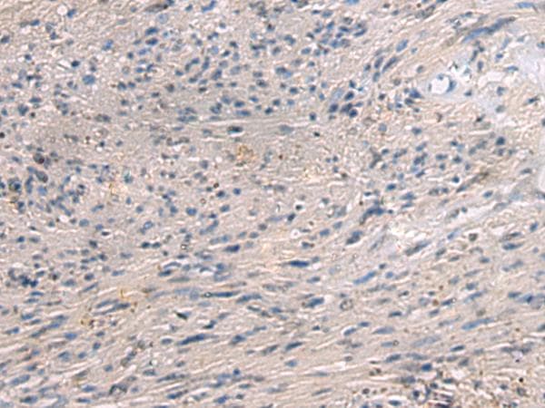 PAIP1 Antibody