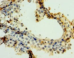 MAGEA6 Antibody (aa75-314)