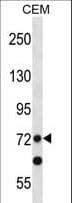 Polyclonal Rabbit anti-Human PRDM8 Antibody (aa75-102, WB)