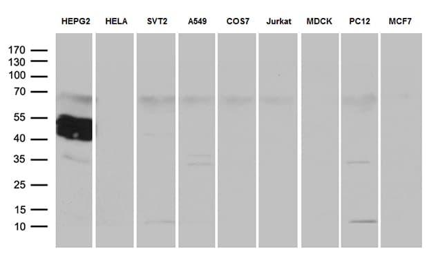Monoclonal Mouse anti-Human ZCCHC17 / PNO40 / PS1D Antibody (clone OTI1F11, WB)
