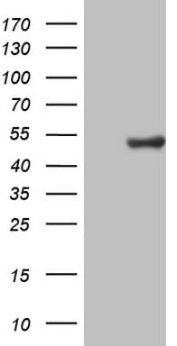 CSNK1G1 / CKI-Gamma 1 Antibody (aa163-422, clone OTI8H1)