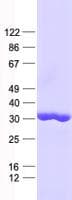 Human RGS18 Protein (Recombinant His, N-Terminal)