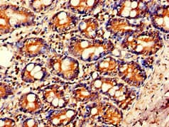 Polyclonal Rabbit anti-Human IL23A / IL-23 p19 Antibody (IHC, IF)