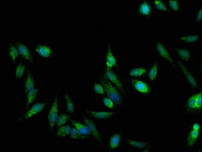 Polyclonal Rabbit anti-Human TRAP1 / HSP75 Antibody (IF, WB)