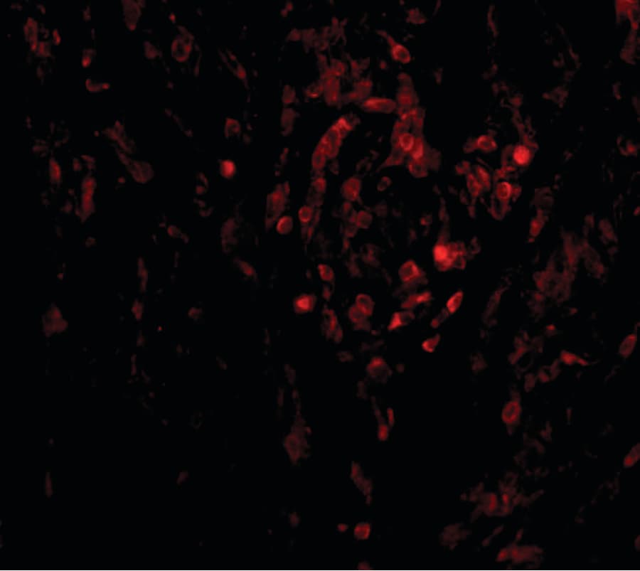 IHC-plus™ TRAF3IP2 / ACT1 Antibody