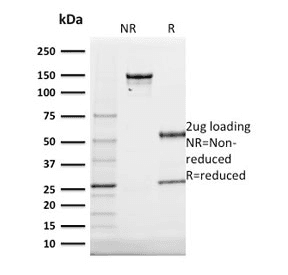 Monoclonal Mouse anti-Human KRT20 / CK20 / Cytokeratin 20 Antibody (clone KRT20/1991, Azide-free,BSA-free, IHC, WB)