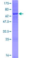 Human ABHD6 Protein (Recombinant GST)