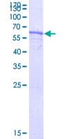 Human KIR2DS5 Protein (Recombinant GST)