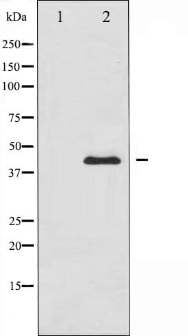 SERPINE1 / PAI-1 Antibody