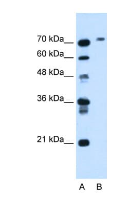 BCHE / Cholinesterase Antibody (aa151-200)