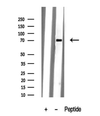 KCNC4 / Kv3.4 Antibody