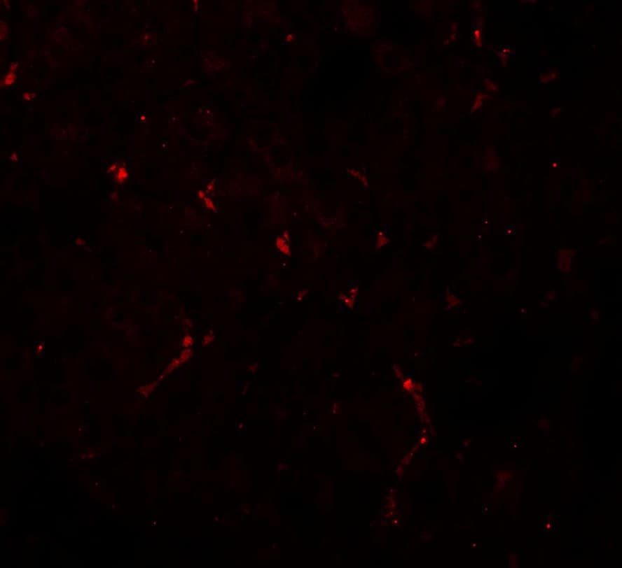 IHC-plus™ Polyclonal Rabbit anti-Human NOSTRIN Antibody (IHC, IF, WB)