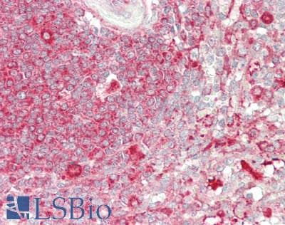 IHC-plus™ Polyclonal Rabbit anti-Human RPS3 / Ribosomal Protein S3 Antibody (aa1-50, IHC, WB)