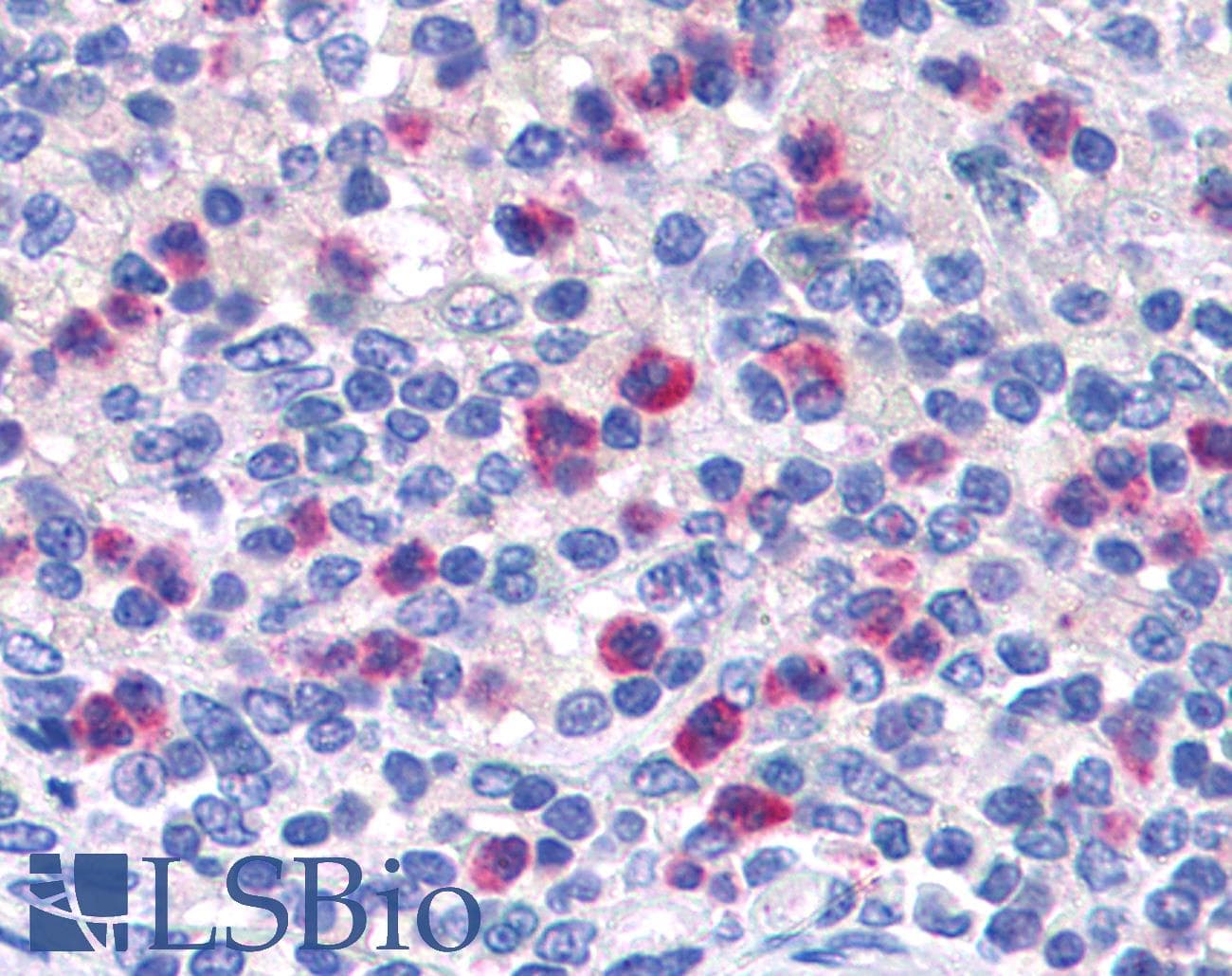 IHC-plus™ PGLYRP1 / PGRP Antibody (aa179-189)