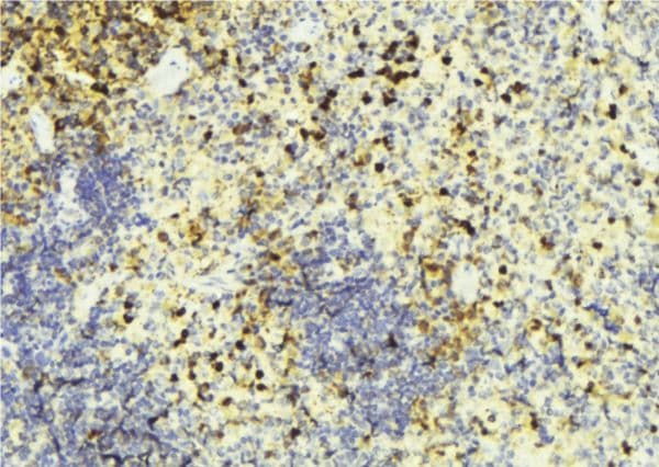 Polyclonal Rabbit anti-Human BRI3BP Antibody (IHC, IF, WB)