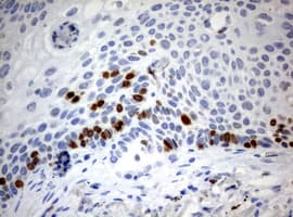 MKI67 / Ki67 Antibody (aa1160-1493, clone OTI5E6)