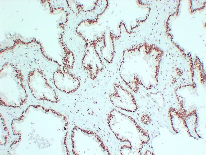AR / Androgen Receptor Antibody (clone ABT-AR)