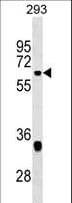 Polyclonal Rabbit anti-Human VEZF1 Antibody (aa142-169, WB)