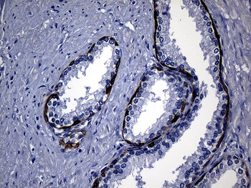 KRT14 / CK14 / Cytokeratin 14 Antibody (aa261-472, clone OTI5F2)