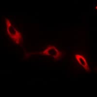 NKTR Antibody