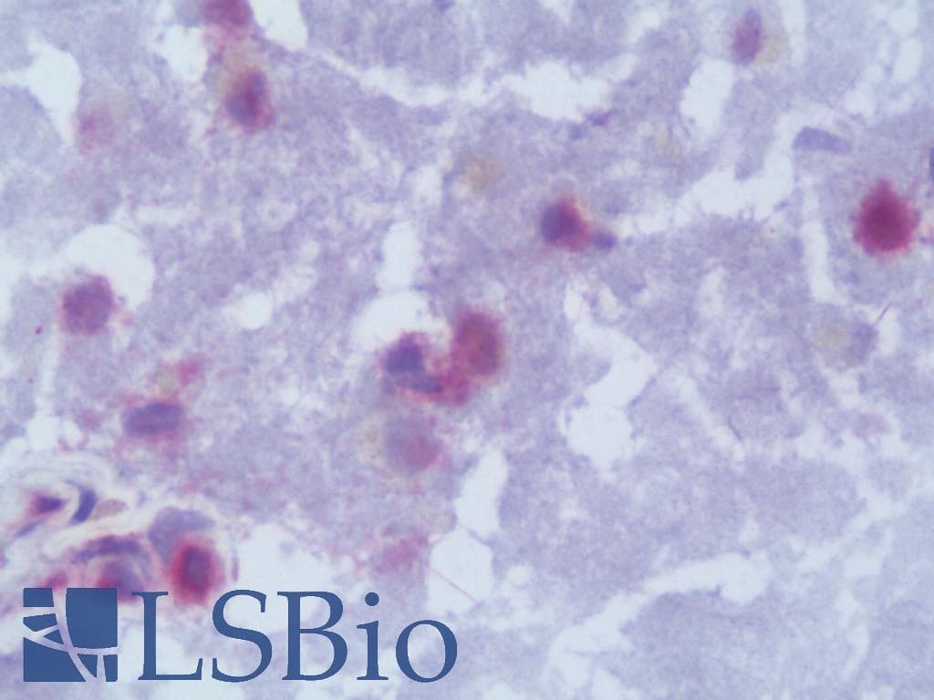 IHC-plus™ LMNB2 / Lamin B2 Antibody (clone LN43)