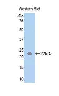 FGF13 Antibody (aa63-245)