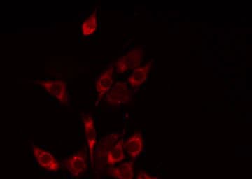 SLC25A21 / ODC1 Antibody