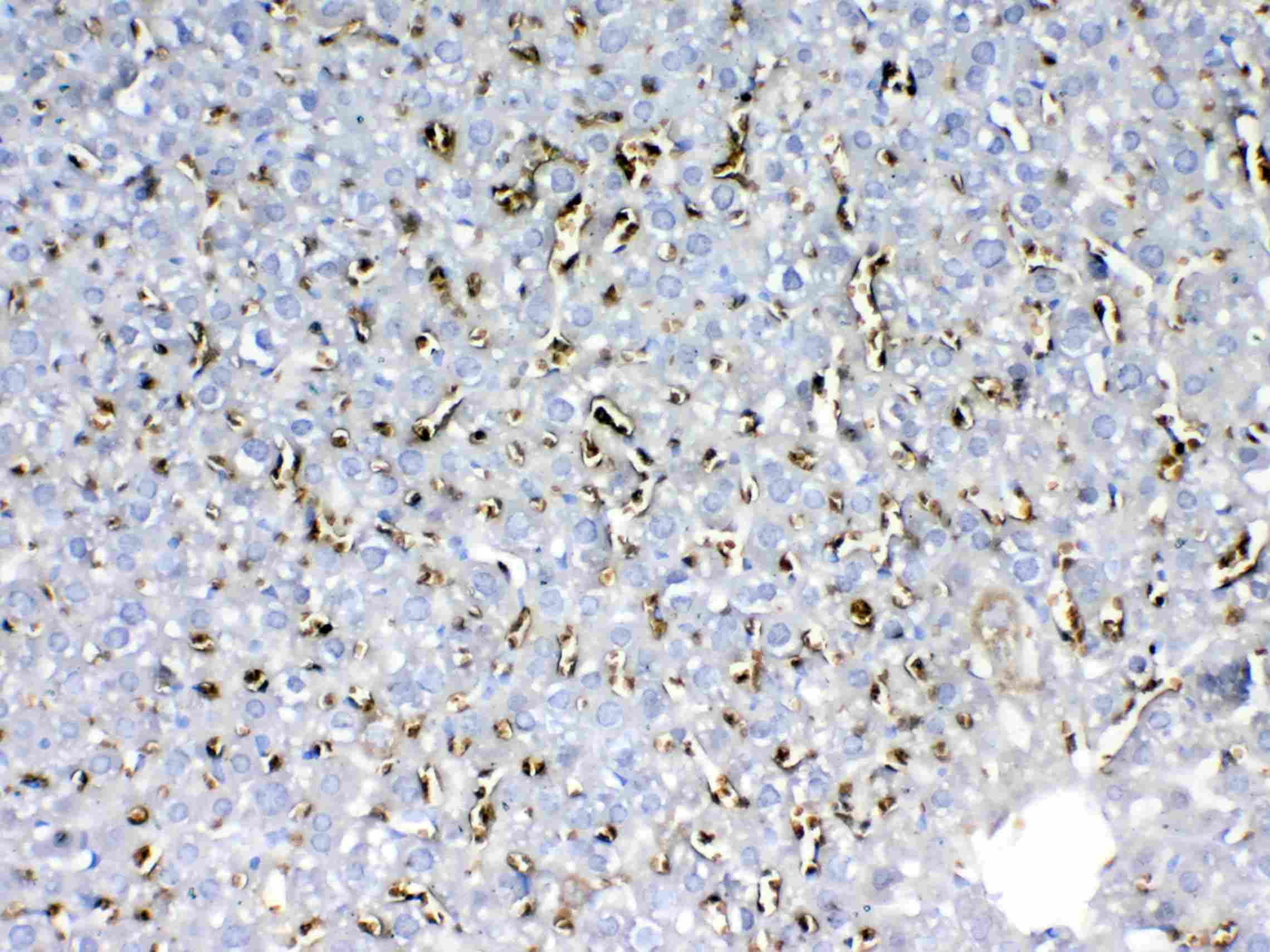 HBD / Hemoglobin Delta Antibody