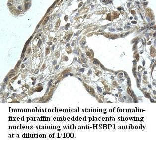 HSBP1 Antibody (aa1-76)