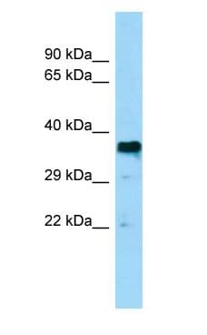 Basigin / Emmprin / CD147 Antibody (aa152-201)