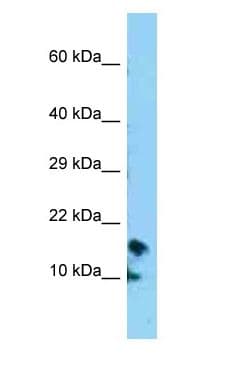 Polyclonal Rabbit anti-Human CRB3 Antibody (N-Terminus, WB)