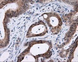 LIPG / Endothelial Lipase Antibody (clone OTI2D5)