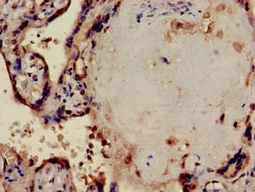 PPP1CA / PP1-Alpha Antibody