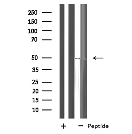 Polyclonal Rabbit anti-Human NLE1 Antibody (IF, WB)
