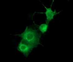 PDGFRB / PDGFR Beta Antibody (clone OTI1G9)
