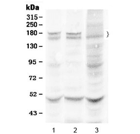 Polyclonal Rabbit anti-Human THBS1 / Thrombospondin-1 Antibody (WB)