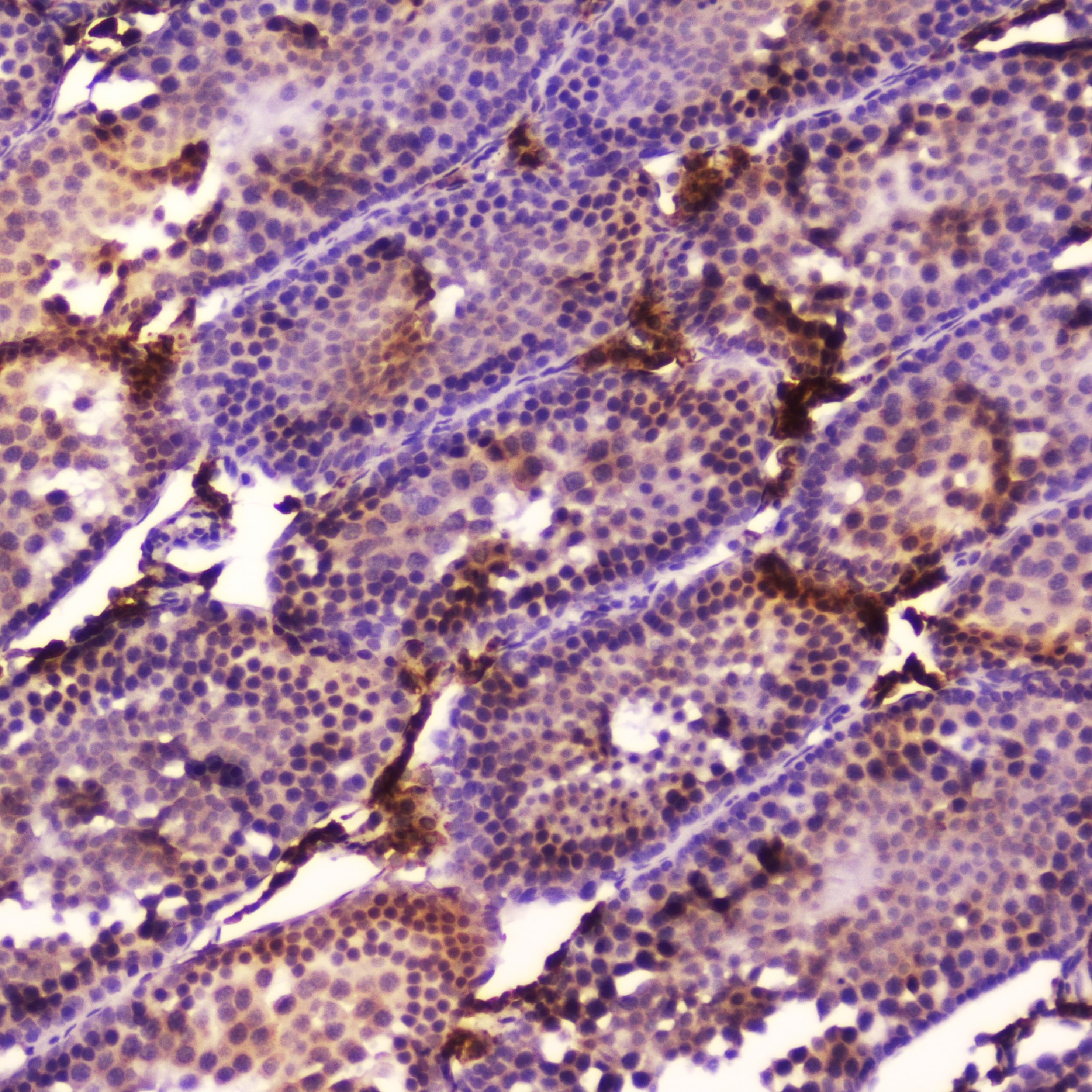 CYP17 / CYP17A1 Antibody