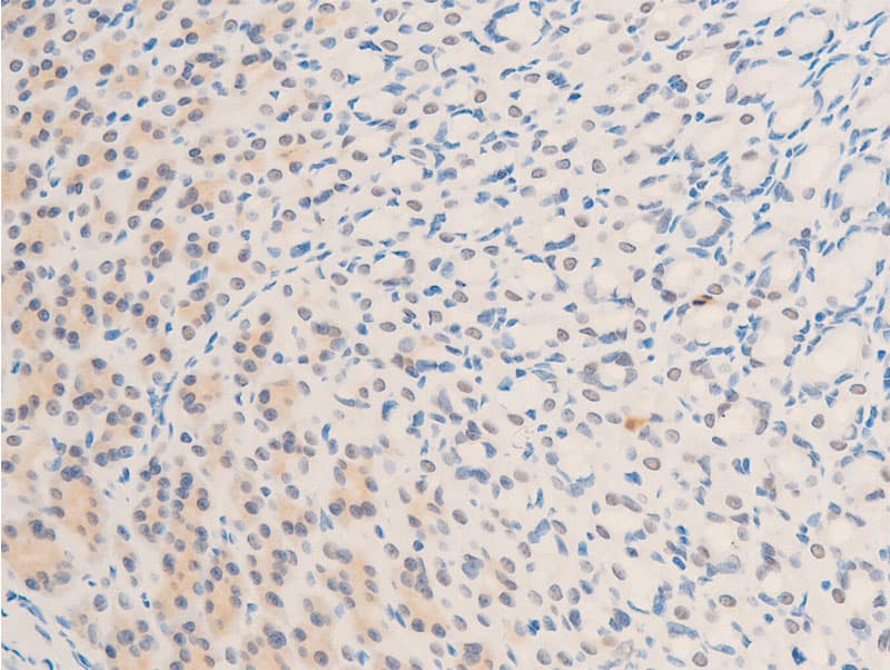 BIRC5 / Survivin Antibody (phospho-Thr117)