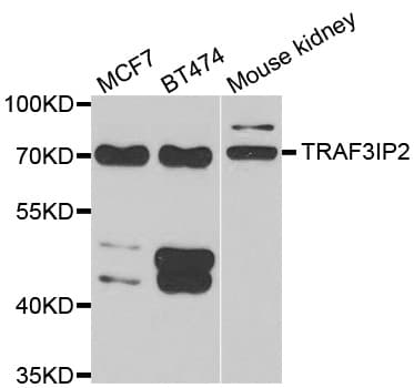 Polyclonal Rabbit anti-Human TRAF3IP2 / ACT1 Antibody (IHC, WB)