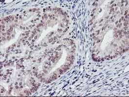PGAM2 Antibody (clone OTI1C1)