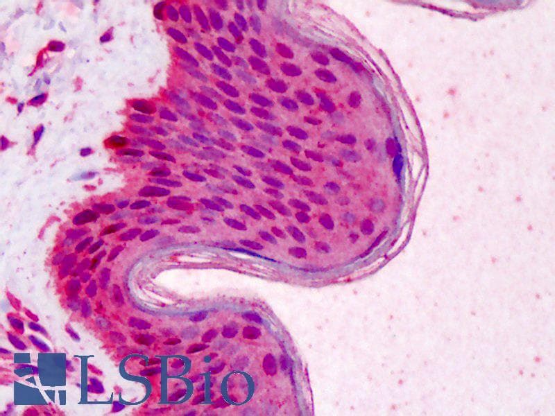 IHC-plus™ RAD51 / RECA Antibody (clone 13E4, Preservative Free)