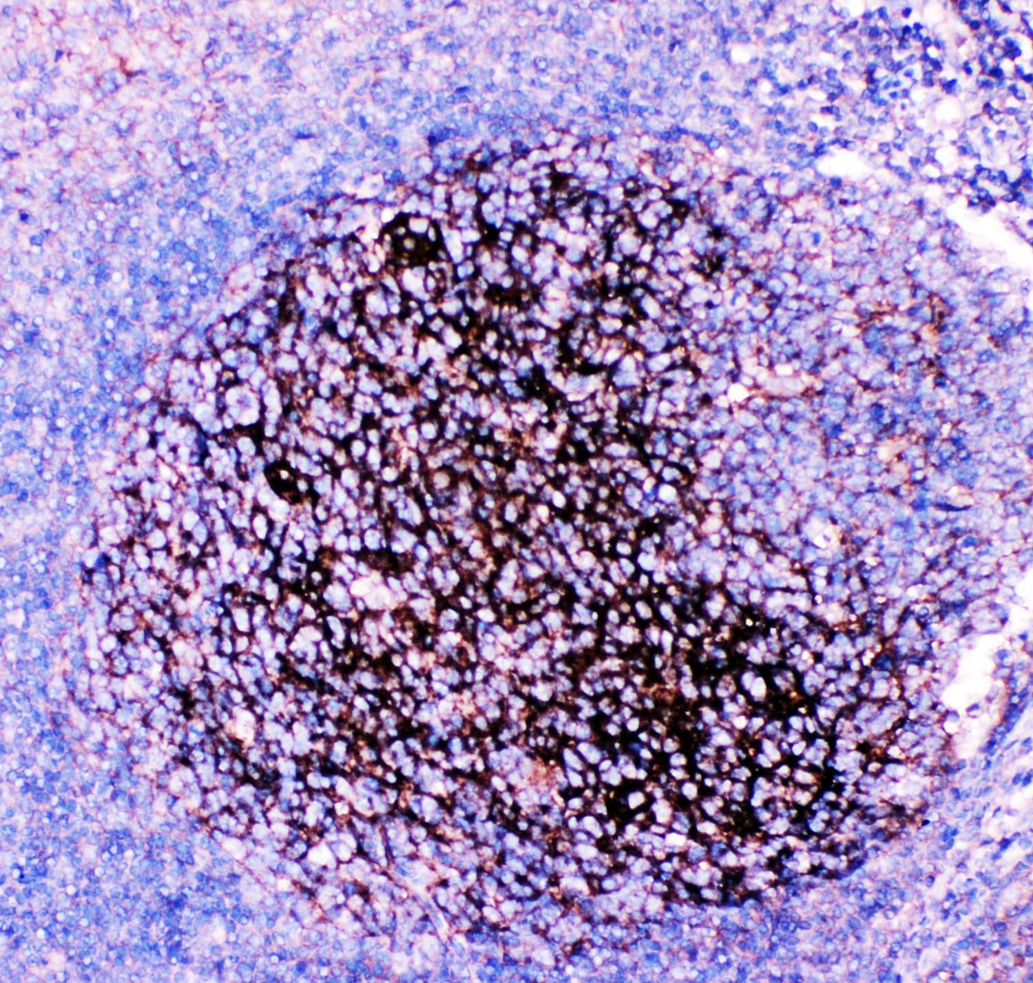 CD82 Antibody (aa98-267)