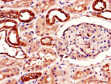 ADORA2B/Adenosine A2B Receptor Antibody