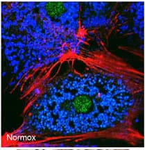 Polyclonal Rabbit anti-Human NIP3 / BNIP3 Antibody (aa152-187, IHC, IF, WB)